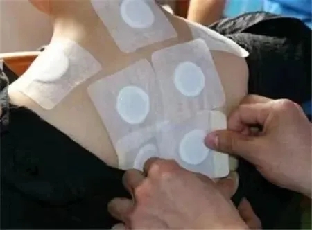 1750901589472595.jpg 三伏貼 (2).jpg