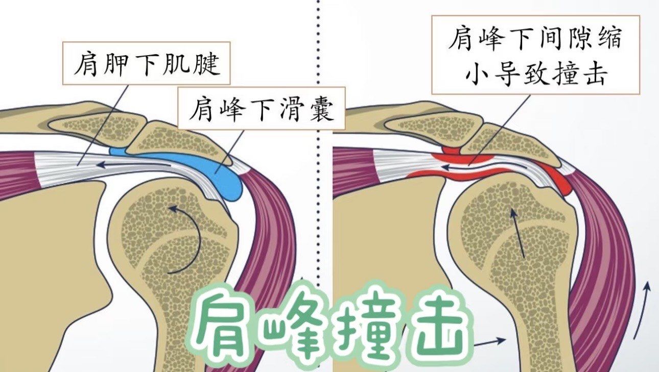 1758528271704495.jpg ee4511491808f3b73cefbea2a5e31672_ZOPy7gslPSlnMgUltZjYFWDkhMnp8dfzXbQ9u_HEYtmySPacgaresLSv1s7xx5Lu.jpg